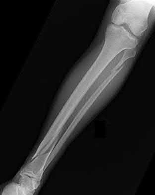 Illustration 194 for OrthoCash: Trauma MCQs & Cases for a yearold woman