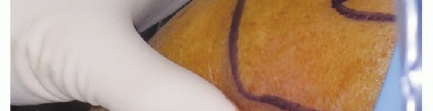 Understanding Shoulder Arthroscopy: The Basics You Need