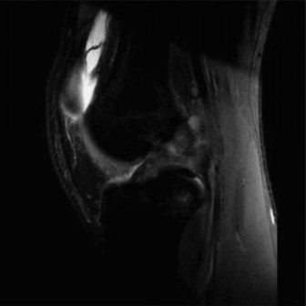 Pediatric Pain & Swelling: 16 Cases Solved & Diagnoses Revealed