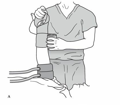 Optimizing Orthopaedic Analgesia: Key Strategies for Relief