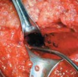 Illustration 23 for Cruciate Ligament Repair: Definitive Guide to Treatment & Recovery