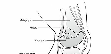 Illustration 23 for Master Pediatric Femoral Shaft & Knee Fractures: Interactive Module