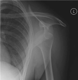 Illustration 27 for Ace FRCS Orthopaedics: Oxford University Press Adult Pathology Viva