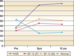 Illustration 141 for Successful Total Hip Replacement in Developmental Dysplasia