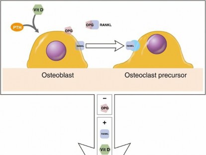Illustration of bone matrix bone - Dr. Mohammed Hutaif