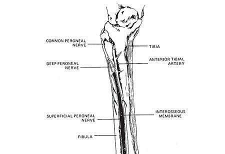 Tibiafibula Shaft Fractures: Causes, Symptoms & Care
