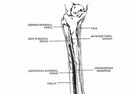 كسور عظم الساق والشظية: دليل شامل للمرضى مع الأستاذ الدكتور محمد هطيف