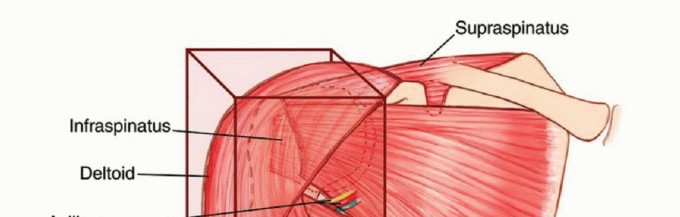 Illustration 12 for Limb-Sparing Resections Around the Shoulder: Optimizing Outcomes