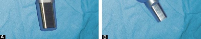 Illustration 26 for Considering METHA Short Stem? Discover Bone-Preserving THA