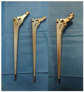 Illustration 48 for Cement in Cement Revision: Simplifying Complex Hip Revisions