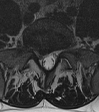 Illustration 6 for Master Orthopedic Spine Cases: Sharpen Your Diagnostic Skills
