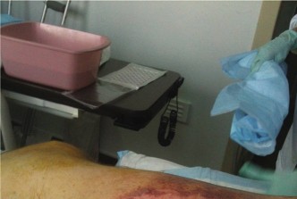 Illustration 2 for Mastering Necrotizing Soft Tissue Diagnosis with LRINEC Criteria