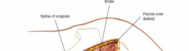Illustration 167 for Essential Guide: Mastering Every Approach to the Shoulder