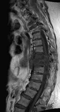 Illustration 10 for OrthoCash: Trauma MCQs & Cases for a yearold woman