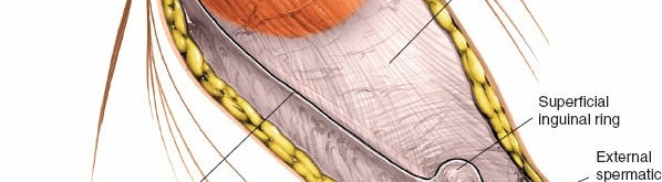 Illustration 59 for Pelvis & Acetabulum Approaches: Unlocking the Posterior Superior Iliac