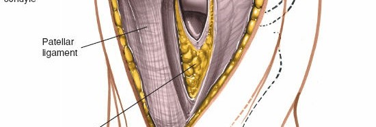 Illustration 37 for Mastering Knee Approaches: Spotlight on Superficial Medial Ligament