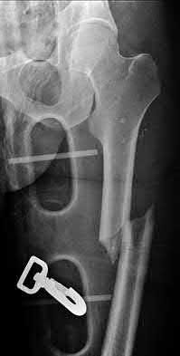 Illustration 176 for OrthoCash: Trauma MCQs & Cases for a yearold woman
