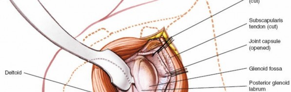 Illustration 40 for Essential Guide: Mastering Every Approach to the Shoulder