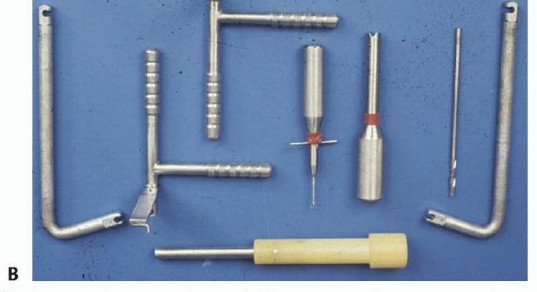 Illustration 6 for Duchenne Muscular Dystrophy: Is Spinal Fusion the Answer?