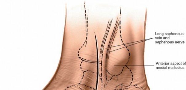 Illustration 16 for Optimized Approaches to the Dorsum of the Foot & Ankle