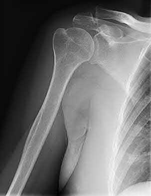 Illustration 149 for OrthoCash: Trauma MCQs & Cases for a yearold woman