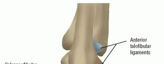 صورة توضيحية لـ وداعاً لالتواءات الكاحل المتكررة: دليلك الشامل لعدم استقرار الكاحل الجانبي والعلاج مع الأستاذ الدكتور محمد هطيف