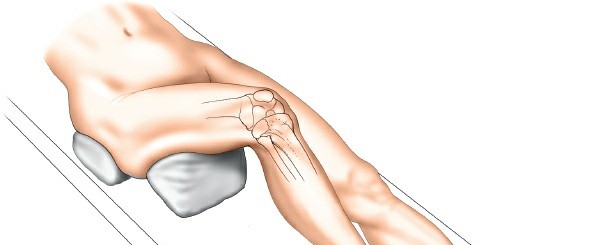 Illustration 7 for Surgical Access: Mastering the Tibia's Surface & Fibula Approaches