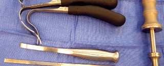 Illustration 13 for Cemented TKA Figure: Your Visual Guide to Surgical Success