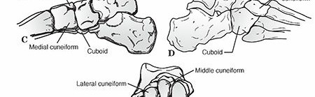 Illustration 3 for Mastering First MTP Joint & Forefoot Fractures: A Comprehensive Guide