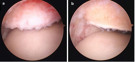 Illustration 22 for First Metatarsal Surgery: Expert Solutions for Foot & Ankle Pain