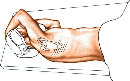 Illustration 307 for Approach to the Lumbar Spine: Mastering Techniques & Anatomy
