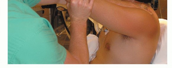 Illustration 21 for Stiff Shoulder? Discover Arthroscopic Capsular Release Solutions