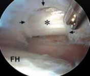 Illustration 13 for J. W. Thomas on Snapping Hip: Causes, Cures & Relief