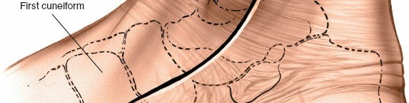 Illustration 33 for Optimized Approaches to the Dorsum of the Foot & Ankle