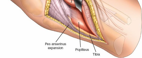 Illustration 42 for Surgical Access: Mastering the Tibia's Surface & Fibula Approaches