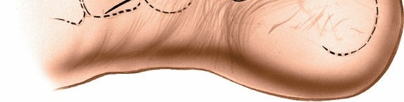 Illustration 34 for Optimized Approaches to the Dorsum of the Foot & Ankle