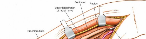 Illustration 17 for Mastering Approaches to the Upper Third of the Radius