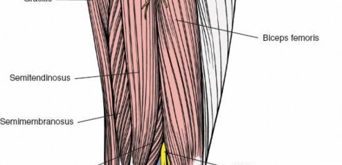 Illustration 118 for Optimal Femoral Approaches: Mastering the Lateral Intermuscular Septum