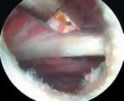 Illustration 23 for J. W. Thomas on Snapping Hip: Causes, Cures & Relief