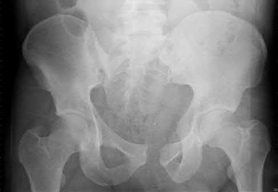 Illustration 175 for OrthoCash: Trauma MCQs & Cases for a yearold woman