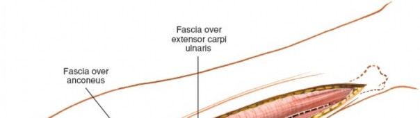 Illustration 47 for Mastering Approaches to the Upper Third of the Radius
