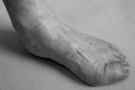 Illustration 2 for Hallux Valgus Exam Prep: Master Oral Questions Hallux Scenarios