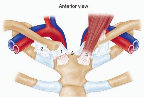 Illustration of medial clavicle excision - Dr. Mohammed Hutaif
