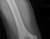 Orthopedic Surgery Mock Exam - Set 0B101D