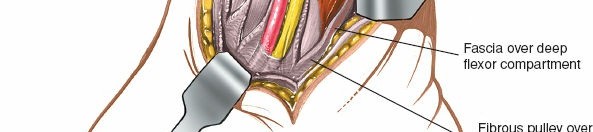Illustration 55 for Optimized Approaches to the Dorsum of the Foot & Ankle