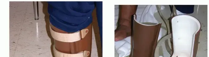 قدم شاركو: دليل شامل للمرضى في اليمن والخليج - علاج وتشخيص الأستاذ الدكتور محمد هطيف