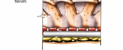 Illustration 184 for Approach to the Lumbar Spine: Mastering Techniques & Anatomy