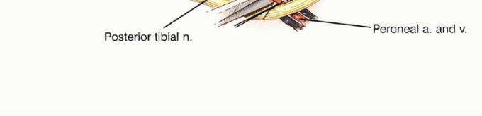 Illustration 24 for Tackling Complex Tumors of the Proximal Tibia: Limb-Sparing Solutions