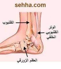 ألم القدم المسطحة؟ اكتشف أسباب ضعف وتر الظنبوب الخلفي وعلاجه