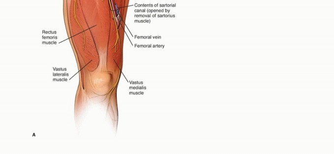 Illustration 3 for Optimizing Adductor Muscle Group Resection for Limb Preservation
